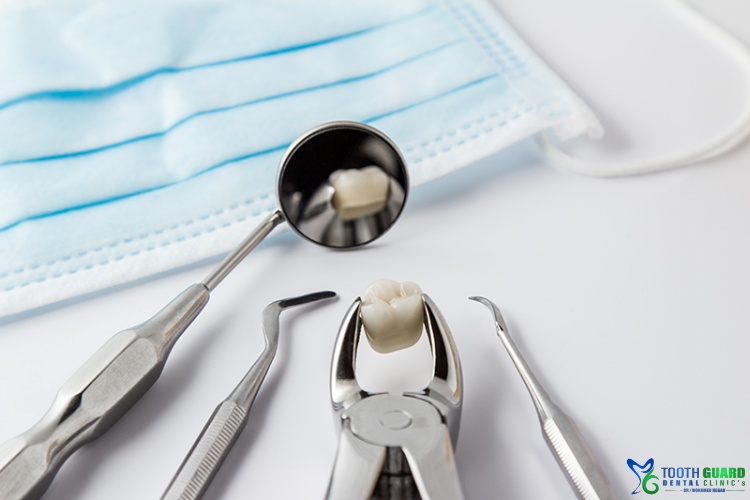 خلع الضرس الملتهب بالخراج :الحلول العلاجية لتجنب المضاعفات